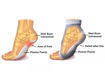 Plantar Fasciitis Sock(s) Pair (OrthoSleeve FS6)