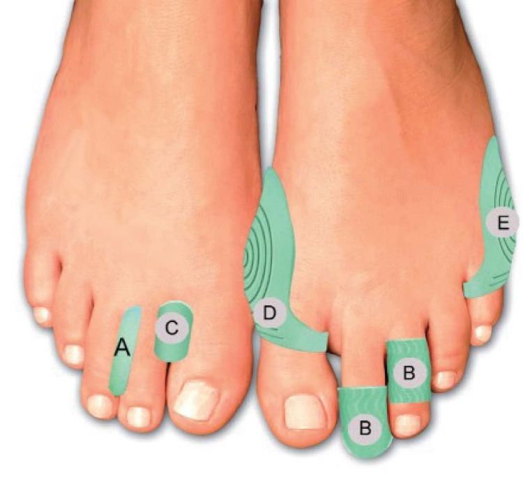 Menthogel- a gel solution for (Arch,Big Toe,Bunion,High Heel Protectors)