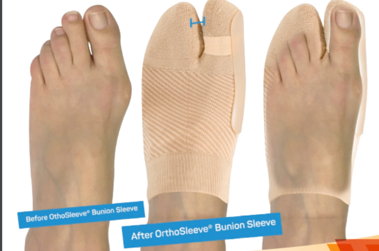 HV3 Bunion Bracing Sleeve (Bunion, Arthritis)