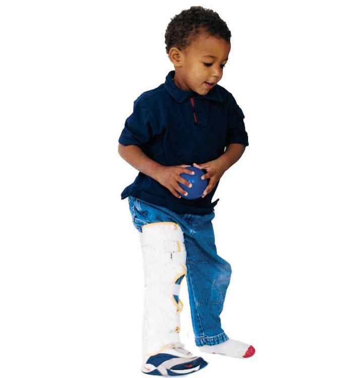 Pediatric Knee Immobilizer