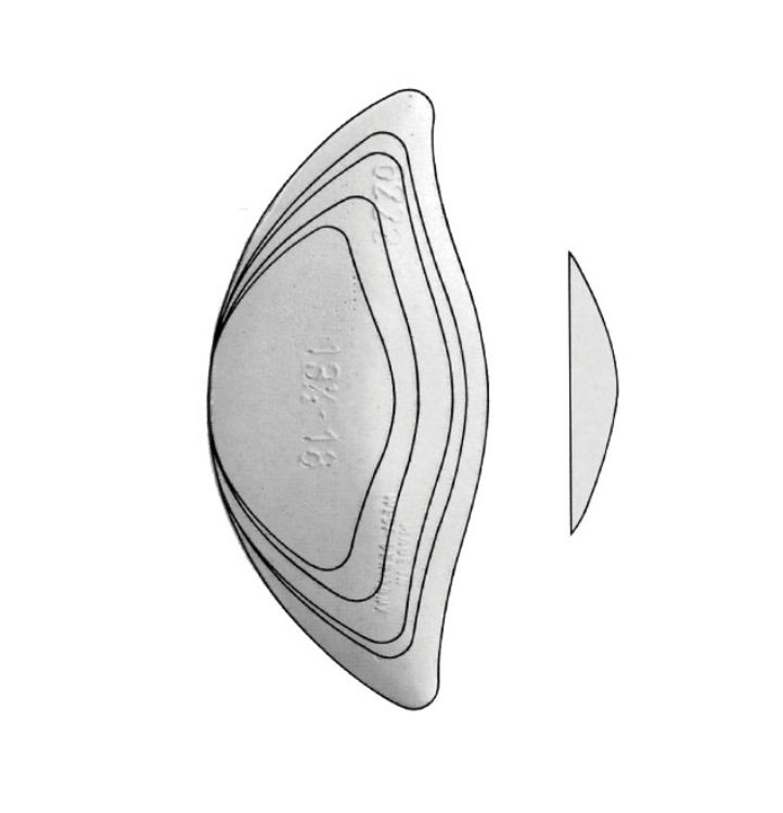 Longitudinal Wedge